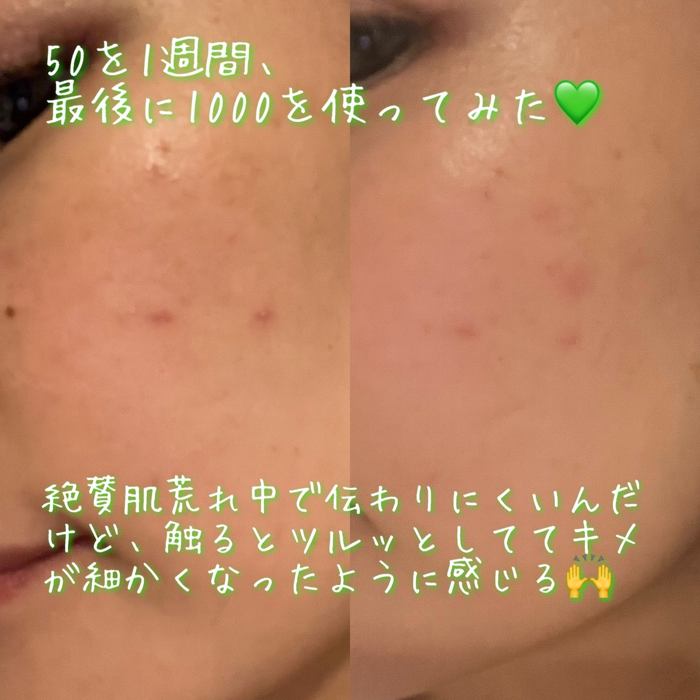 マイルドリードルショット50/VT/美容液を使ったクチコミ(7枚目)