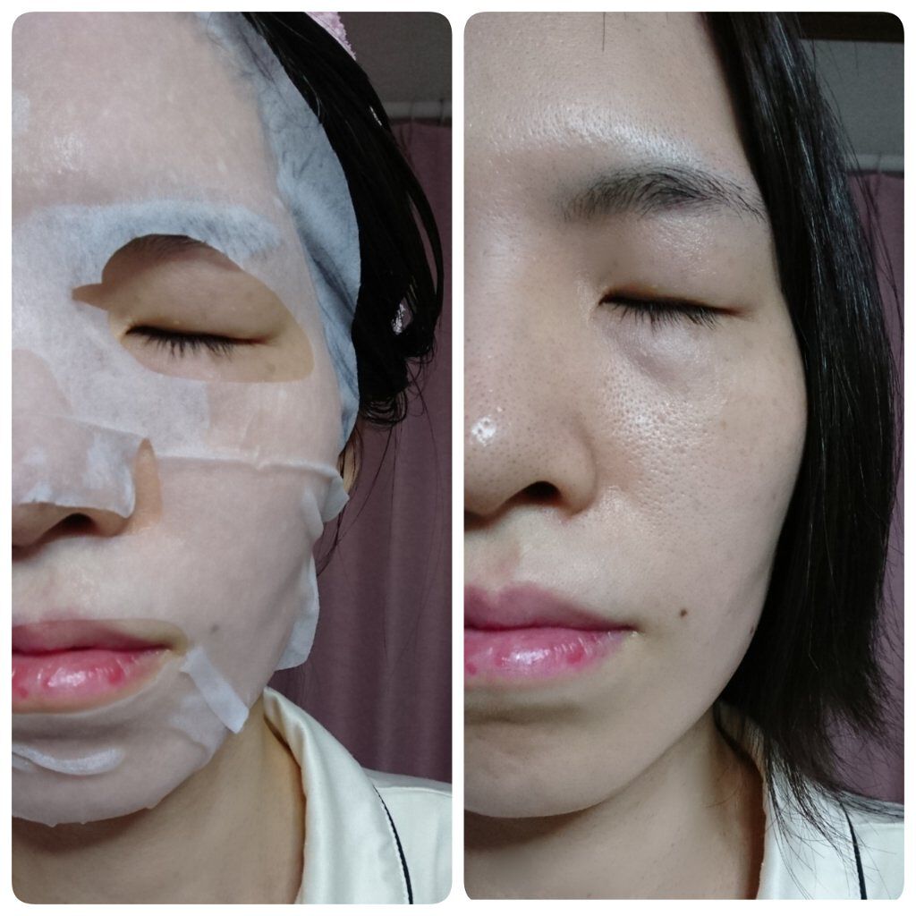 ヘルシークレンズジュースマスクパック/eco secret/シートマスク・パックを使ったクチコミ(7枚目)