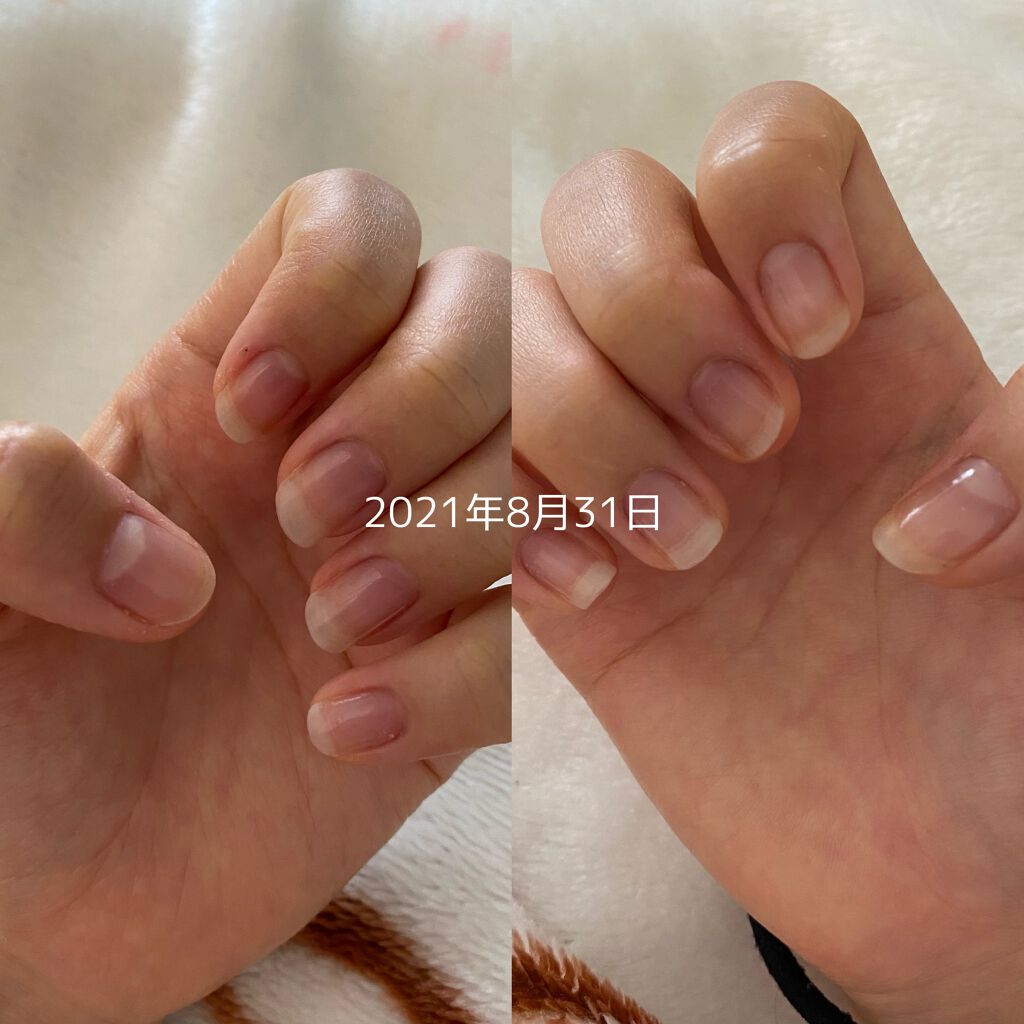 ウィンマックス キューティクルオイル/DAISO/ネイルオイル・トリートメントを使ったクチコミ(4枚目)
