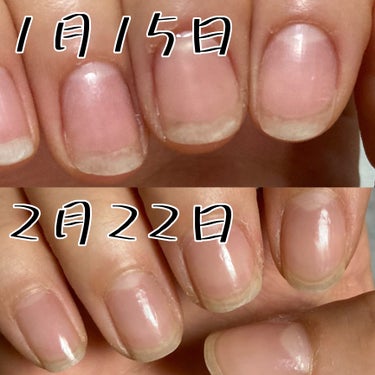 Pro nourishing nail oil/ohora/ネイルオイル・トリートメントを使ったクチコミ（3枚目）