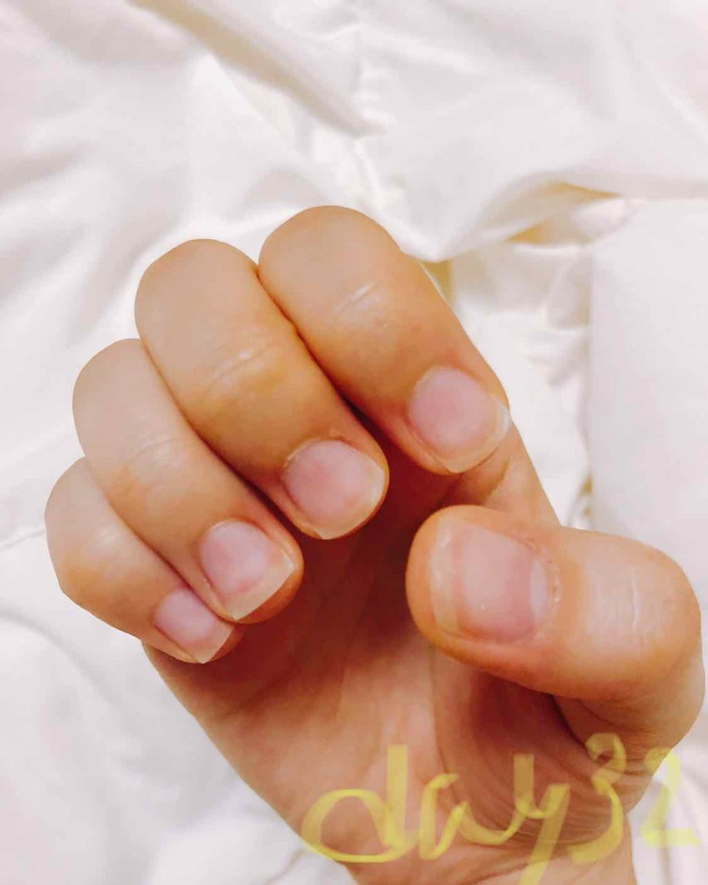 ネイルトリートメント N/ネイルネイル/ネイルオイル・トリートメントを使ったクチコミ（2枚目）