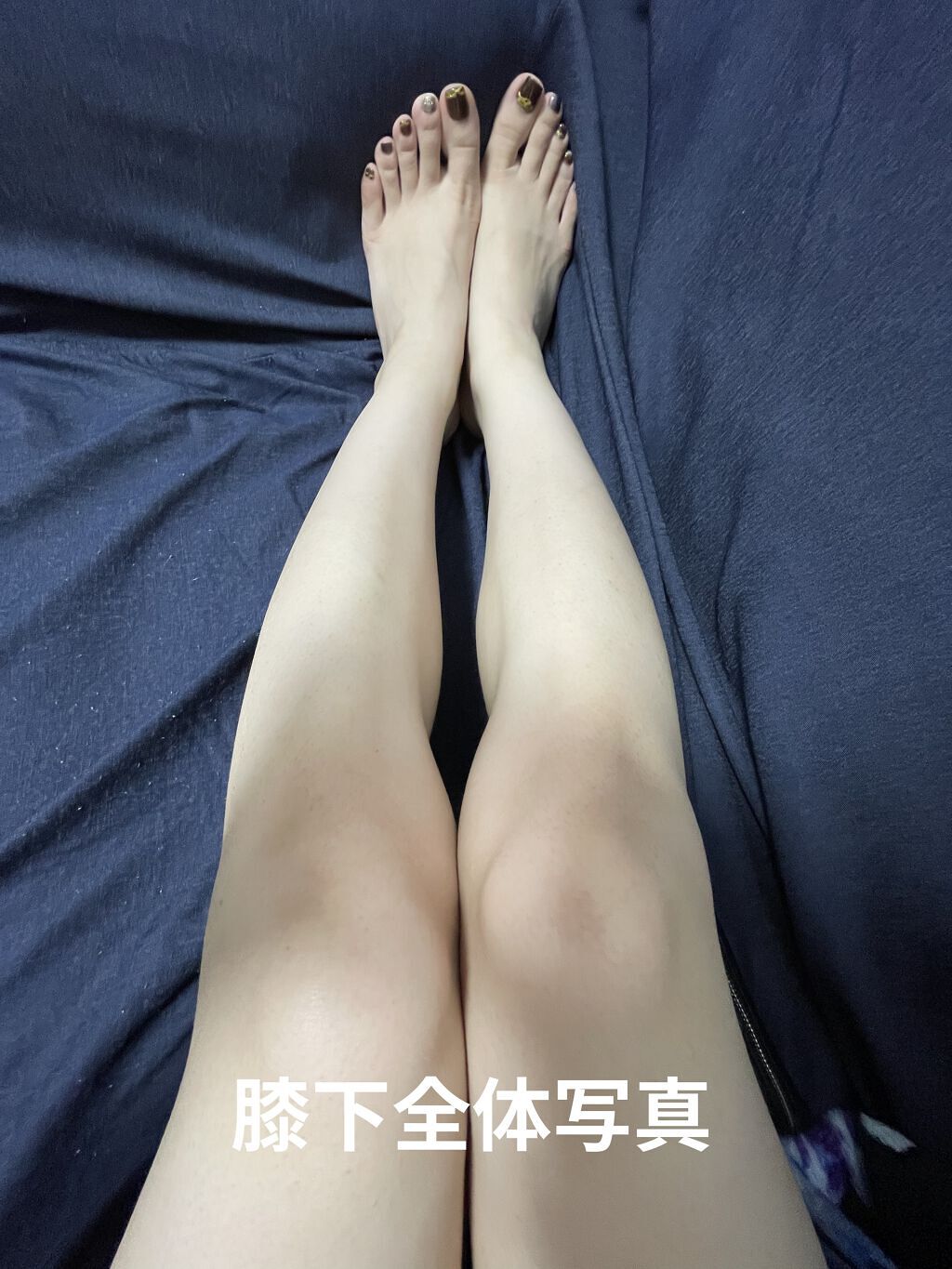 アイスレディ/icelady/家庭用脱毛器を使ったクチコミ（2枚目）