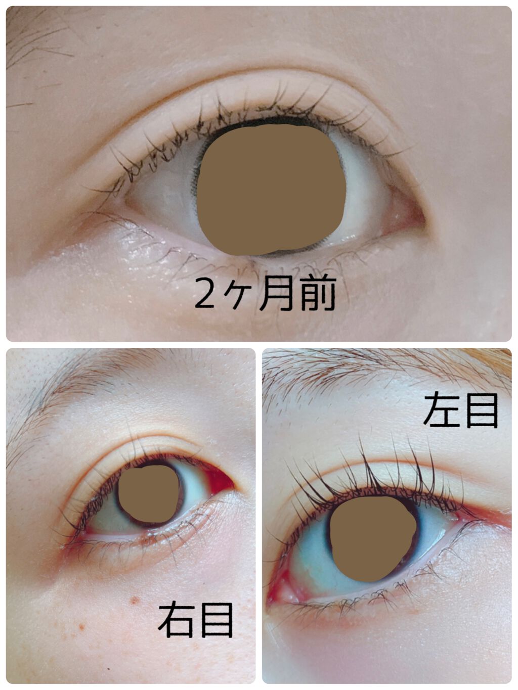 DHCアイラッシュトニック/DHC/まつげ美容液を使ったクチコミ(1枚目)