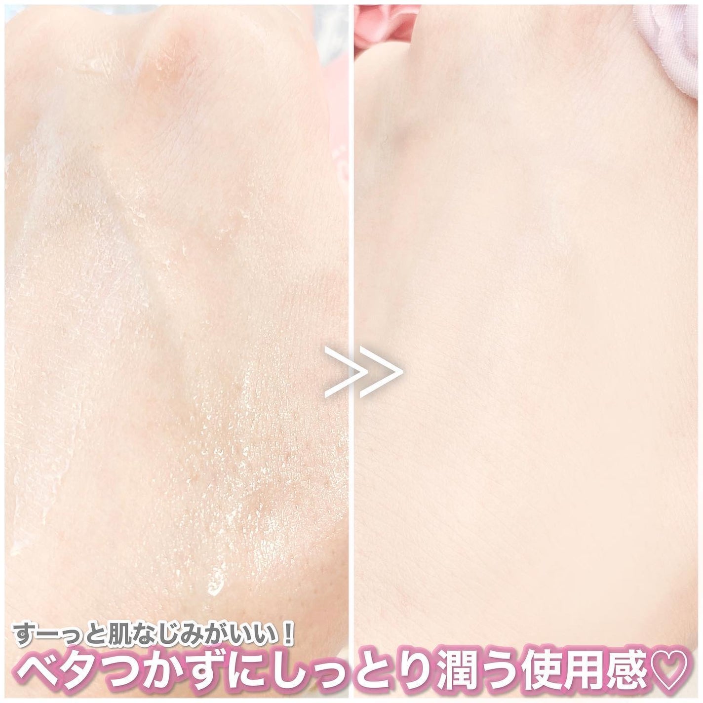 ミストセラム/episode SKIN/美容液を使ったクチコミ(4枚目)