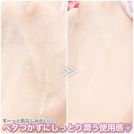 ミストセラム/episode SKIN/美容液を使ったクチコミ(4枚目)