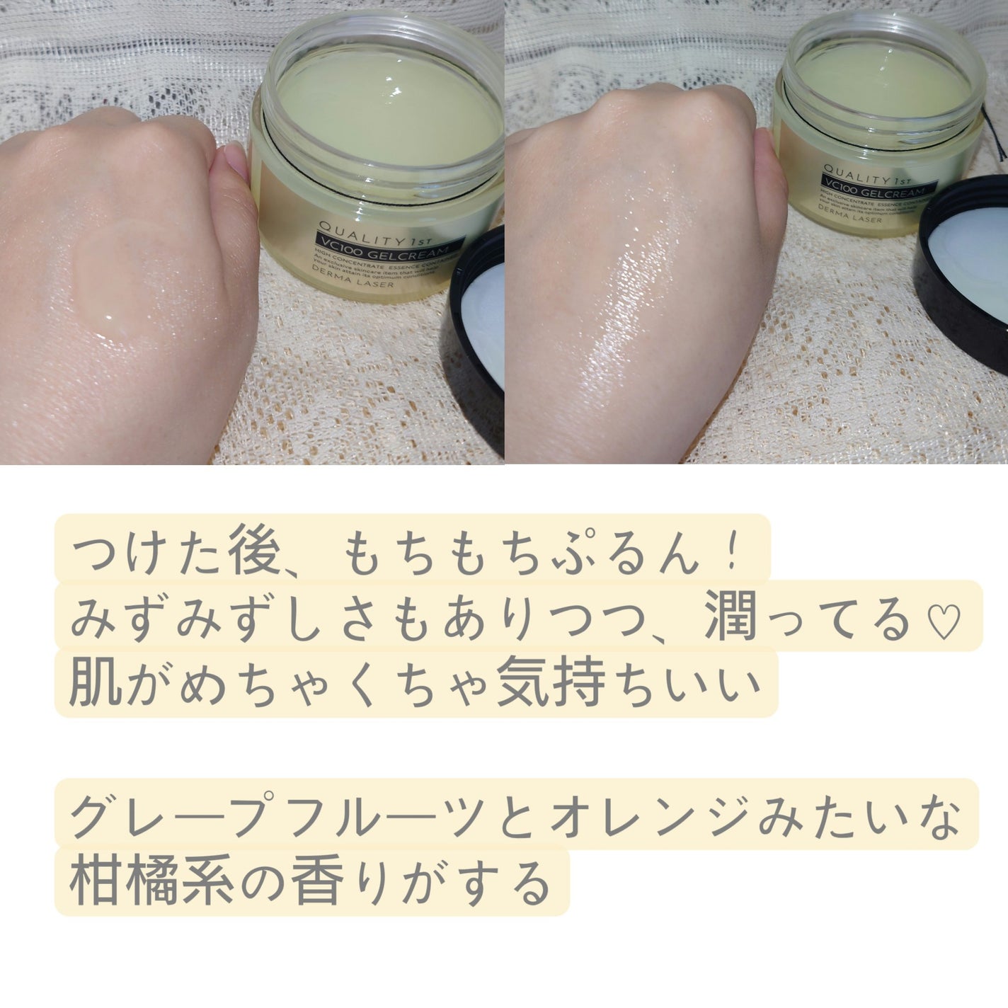 ダーマレーザー スーパーVC100ジェルクリーム/クオリティファースト/フェイスクリームを使ったクチコミ(2枚目)