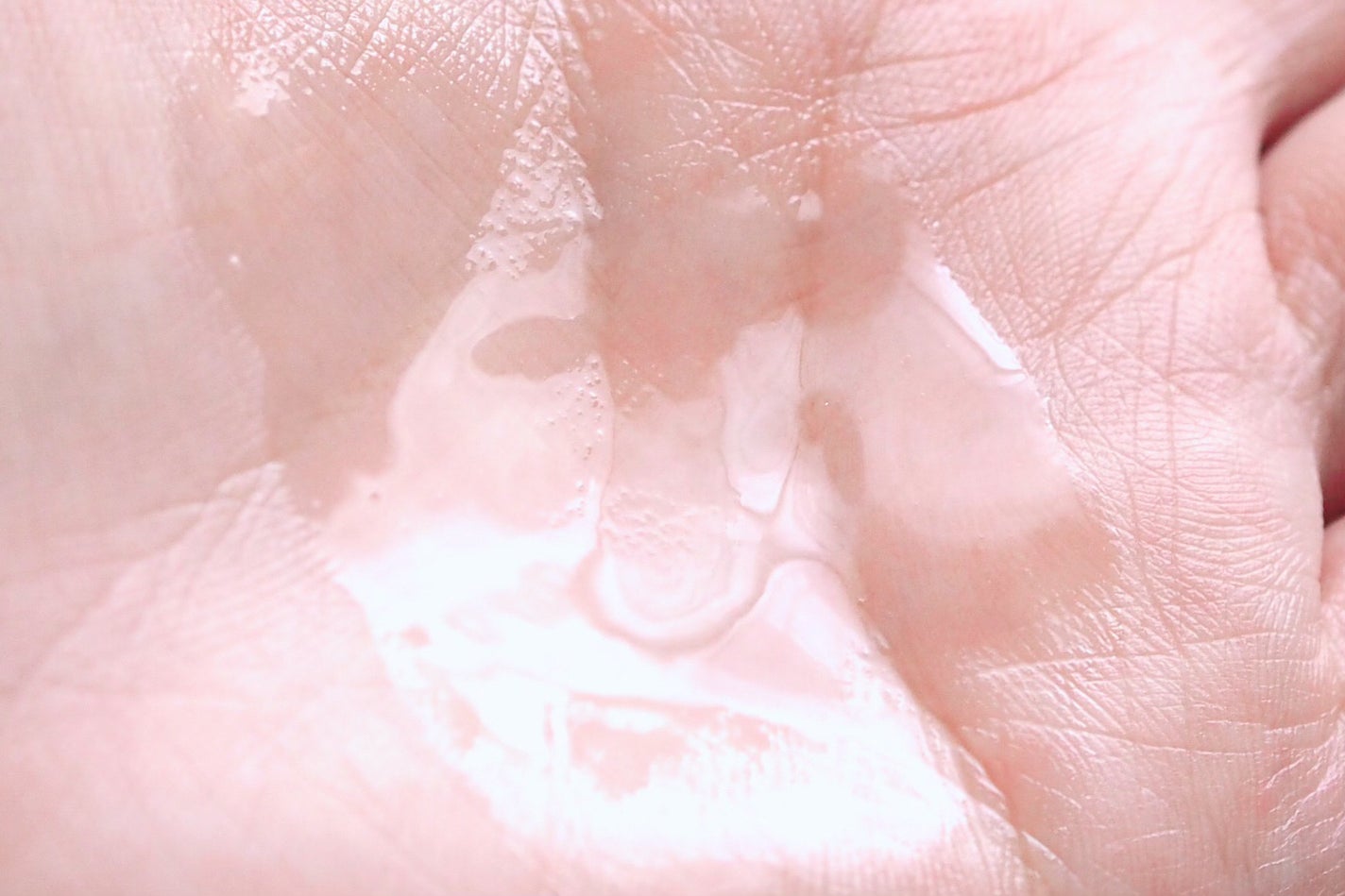 ピンクティーツリーシナジーセラム/APLIN/美容液を使ったクチコミ(5枚目)