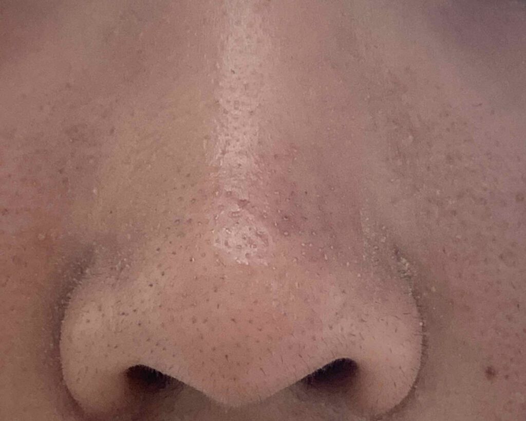 ハトムギ化粧水(ナチュリエ スキンコンディショナー R )/ナチュリエ/化粧水を使ったクチコミ（2枚目）