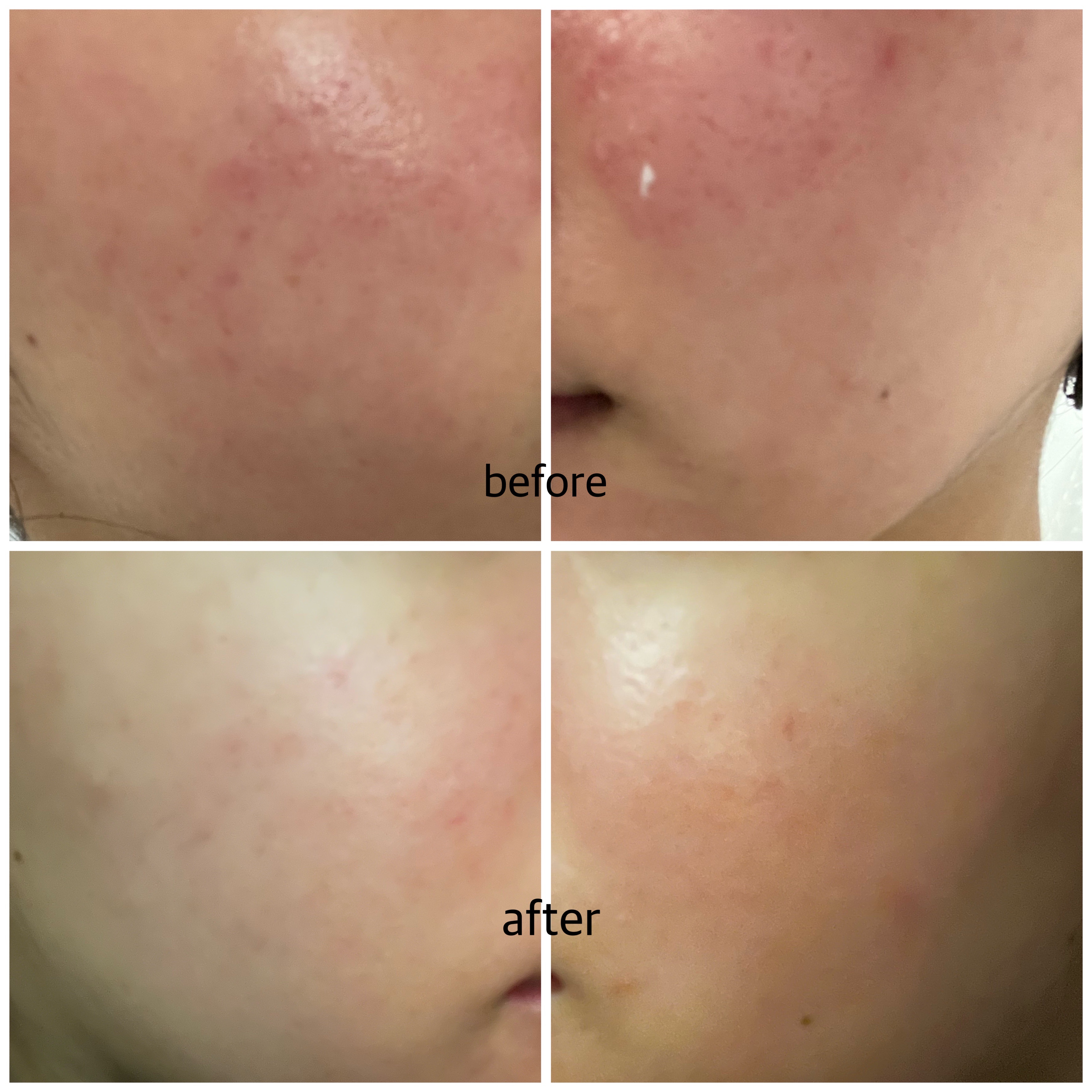 ピグメントビオ ブライトニング ビタミンC フェイスセラム アンチダークスポット/ビオデルマ/美容液を使ったクチコミ（2枚目）