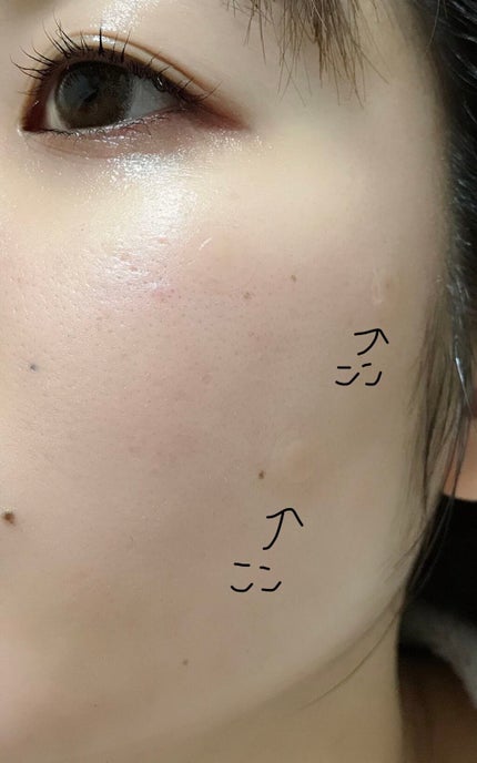 ゼロスポットパッチ/Today’s Cosme/にきびパッチを使ったクチコミ(3枚目)