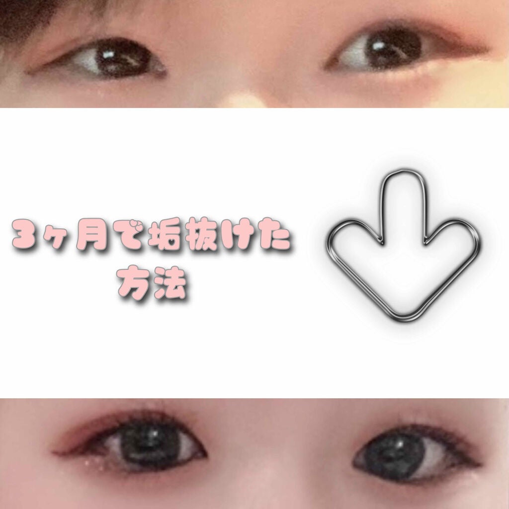 スカルプD ボーテ ピュアフリーアイラッシュセラム/アンファー(スカルプD)/まつげ美容液を使ったクチコミ(1枚目)