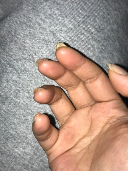 ジェルネイル(ライト対応)/セリア/ジェルネイルを使ったクチコミ(6枚目)