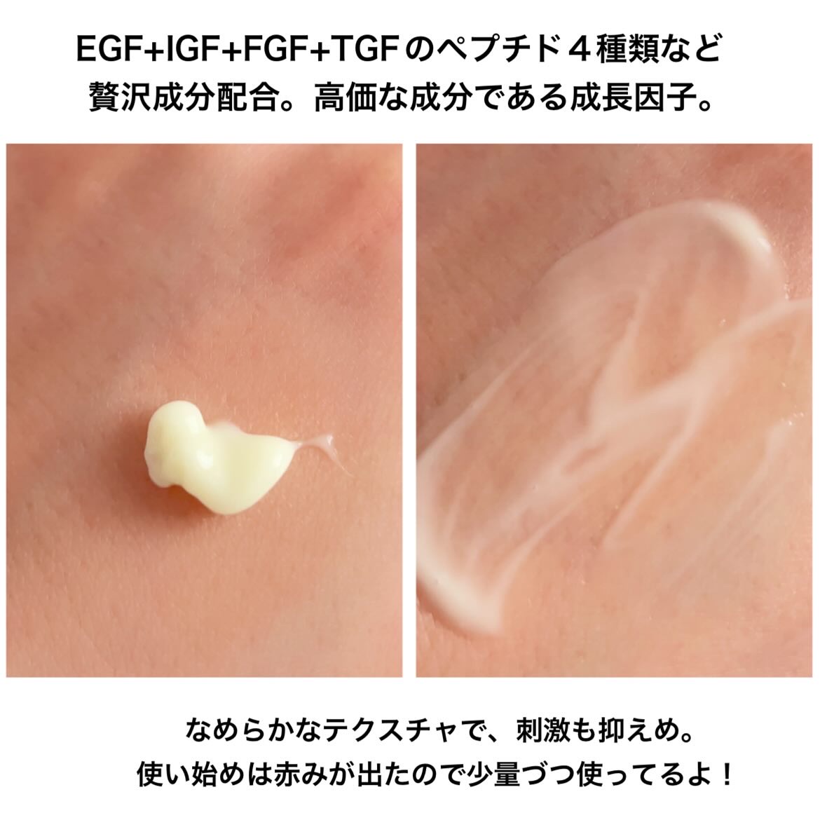 ヴィーガンリポソームレチノールセラム/SKIN&LAB/美容液を使ったクチコミ（3枚目）