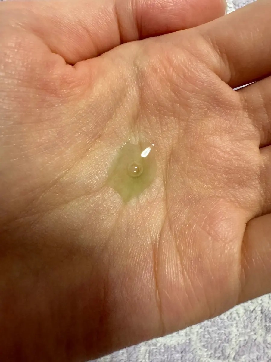 アゼライン酸15 インテンスカーミングセラム/Anua/美容液を使ったクチコミ（3枚目）