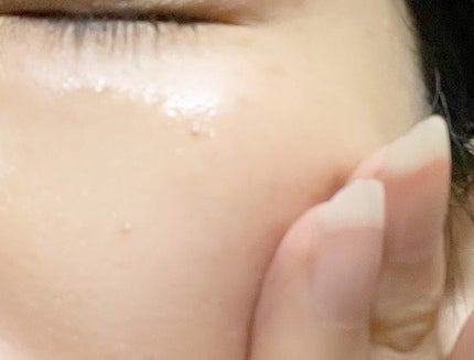 ユズナイアシンアンチブレミッシュセラム/SOME BY MI/美容液を使ったクチコミ(7枚目)