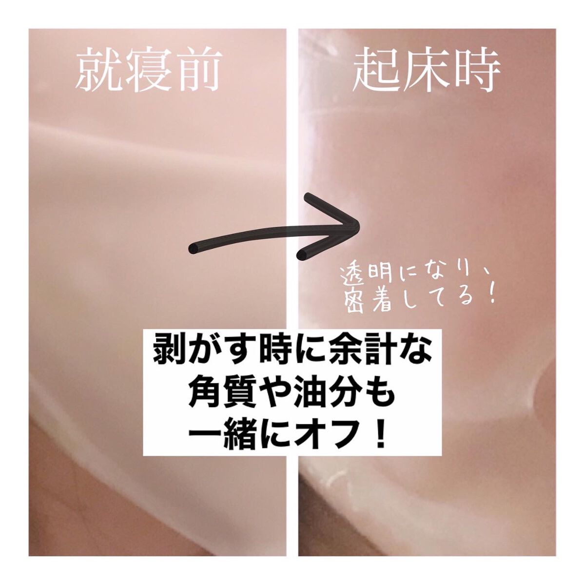 フェイシャル保湿パック 1シート/Dermall matrix/シートマスク・パックを使ったクチコミ（2枚目）