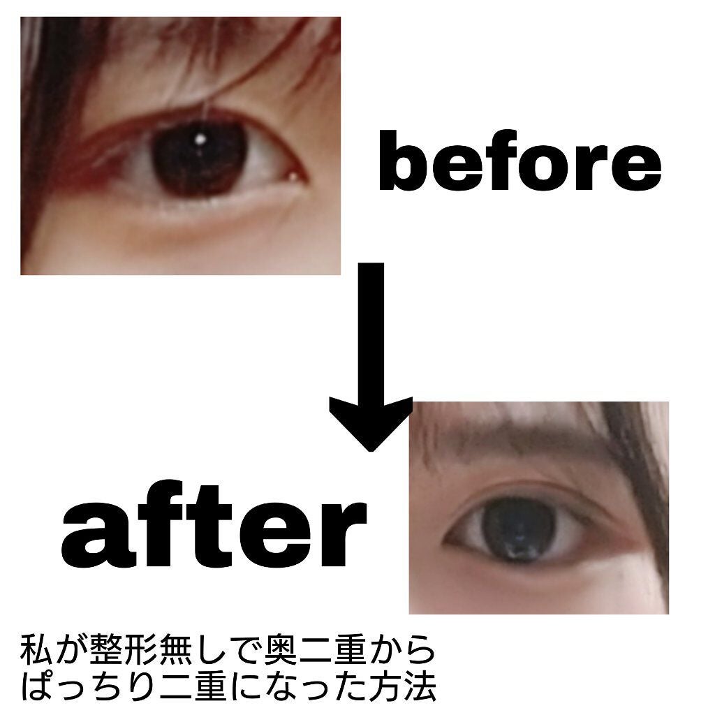 りりあ🐾❤️ on LIPS 「私が整形無しで奥二重からぱっちり二重に生まれ変わった方法✂ーー..」(1枚目)