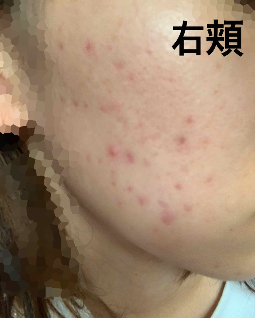 ミノン アミノモイスト モイストチャージ ローションI しっとりタイプ/ミノン/化粧水を使ったクチコミ（2枚目）