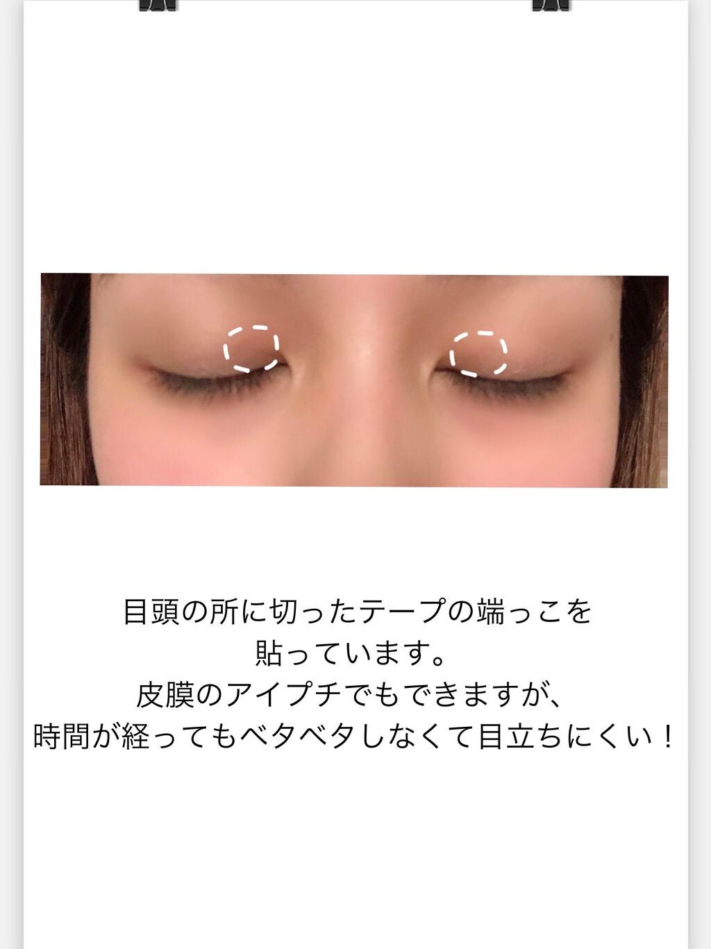 アイテープ片面(のびる)絆創膏タイプ スリム 120枚/セリア/二重まぶた用アイテムを使ったクチコミ(3枚目)