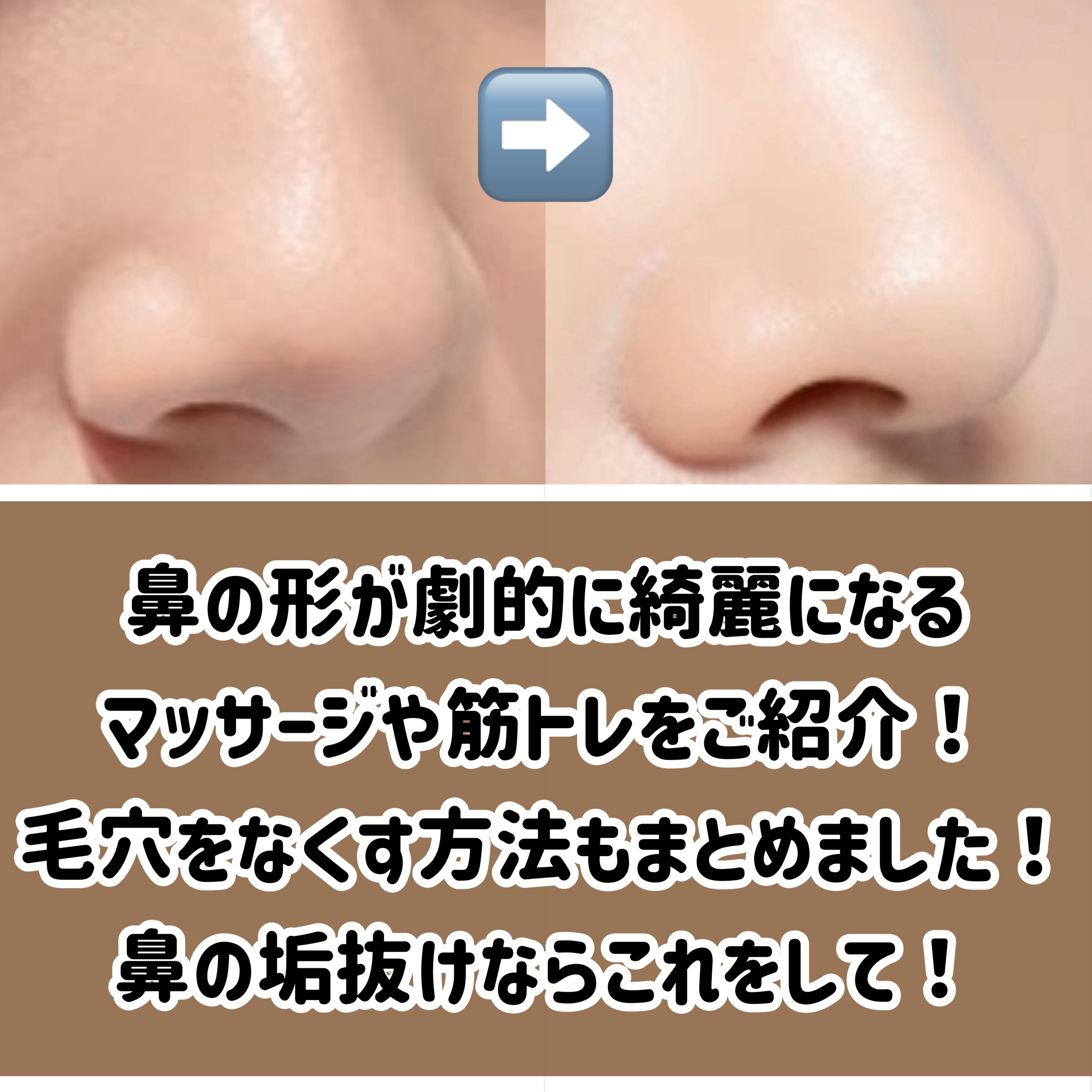 ハトムギ保湿ジェル(ナチュリエ スキンコンディショニングジェル)/ナチュリエ/美容液を使ったクチコミ（2枚目）