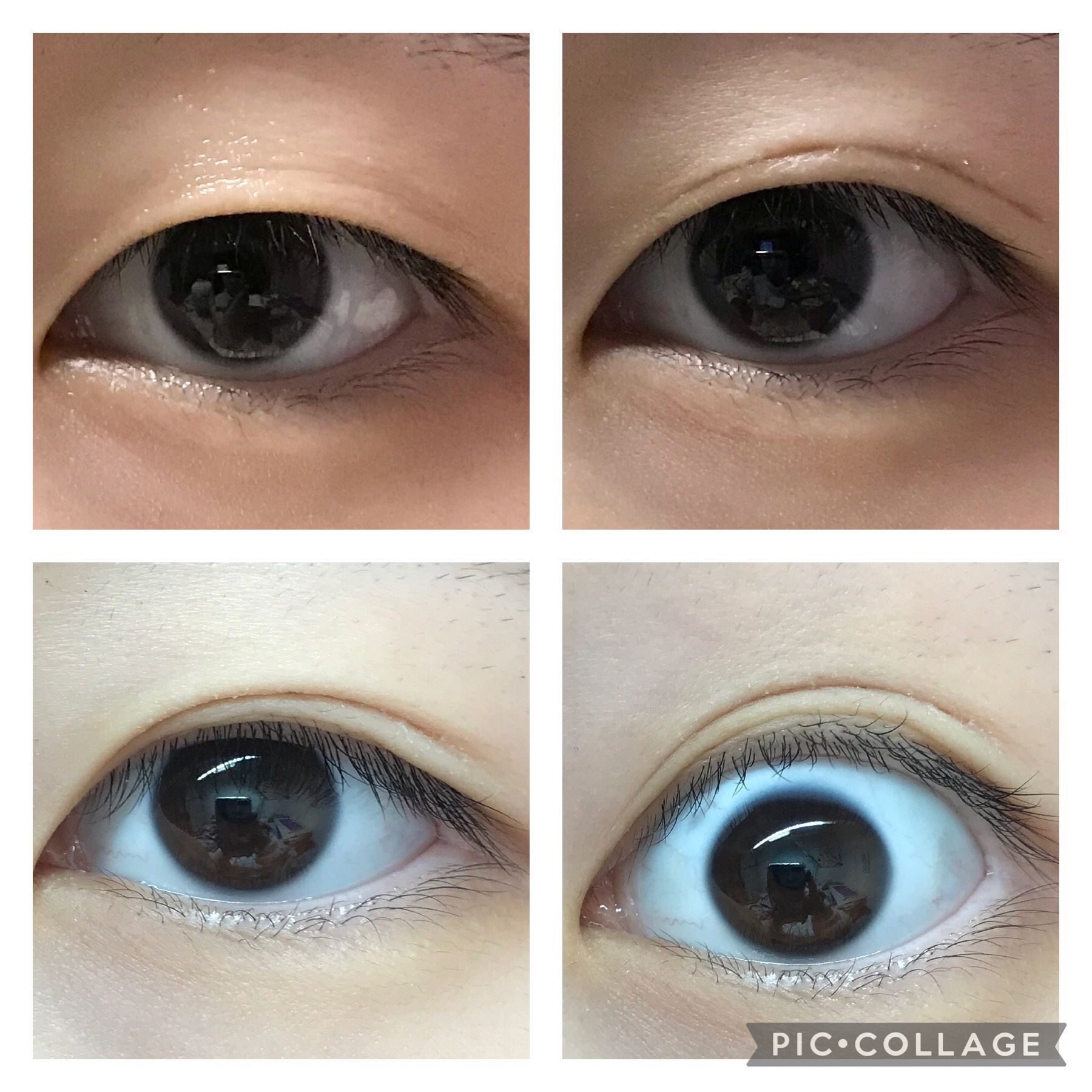 アイトーク スーパーホールド/アイトーク/二重まぶた用アイテムを使ったクチコミ（3枚目）