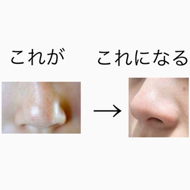 スキンケアオタク on LIPS 「#2022上半期ベスコス使ってみた柑橘王子マジで毛穴なくなる！..」（1枚目）