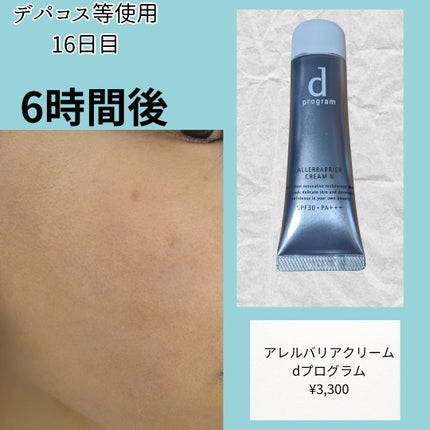 d プログラム アレルバリア クリームのクチコミ「程よく全体と毛穴をカバーしてくれる
艶が出る
そしてしっかりとしたテクスチャー
保湿されてる感.....」(1枚目)