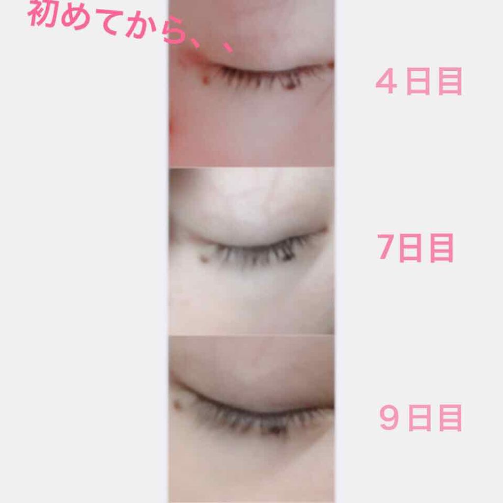 ローヤルゼリー配合 栄養ローション/DAISO/美容液を使ったクチコミ(1枚目)