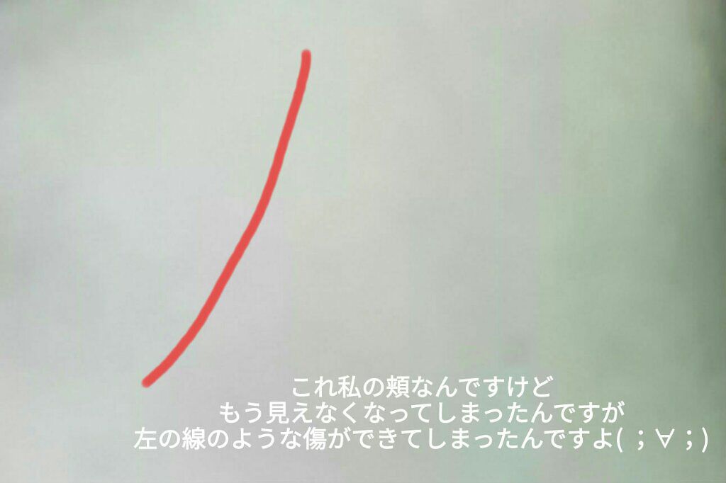 ニベアクリーム/ニベア/ボディクリームを使ったクチコミ（2枚目）