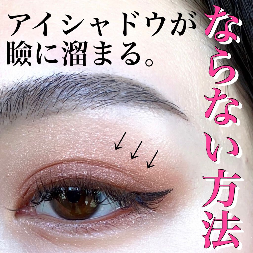 【旧】ディオールスキン フォーエヴァー スキン コレクト コンシーラー/Dior/リキッドコンシーラーを使ったクチコミ（1枚目）