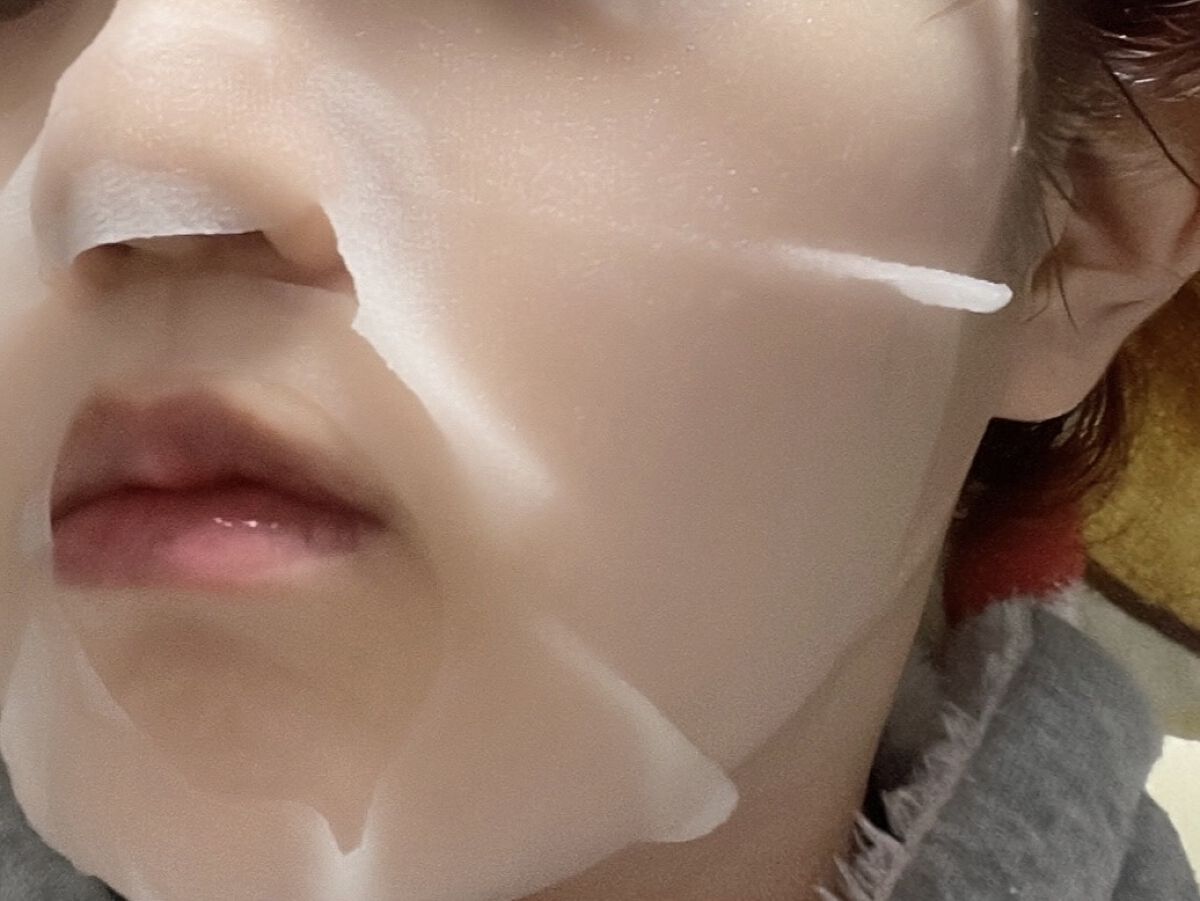 ダーマレーザー スーパーセラミド100マスク/クオリティファースト/シートマスク・パックを使ったクチコミ（3枚目）