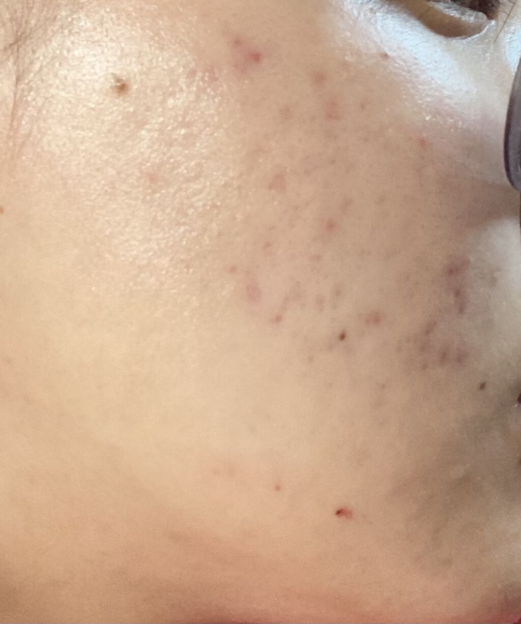 保湿クリーム /ちふれ/フェイスクリームを使ったクチコミ（1枚目）