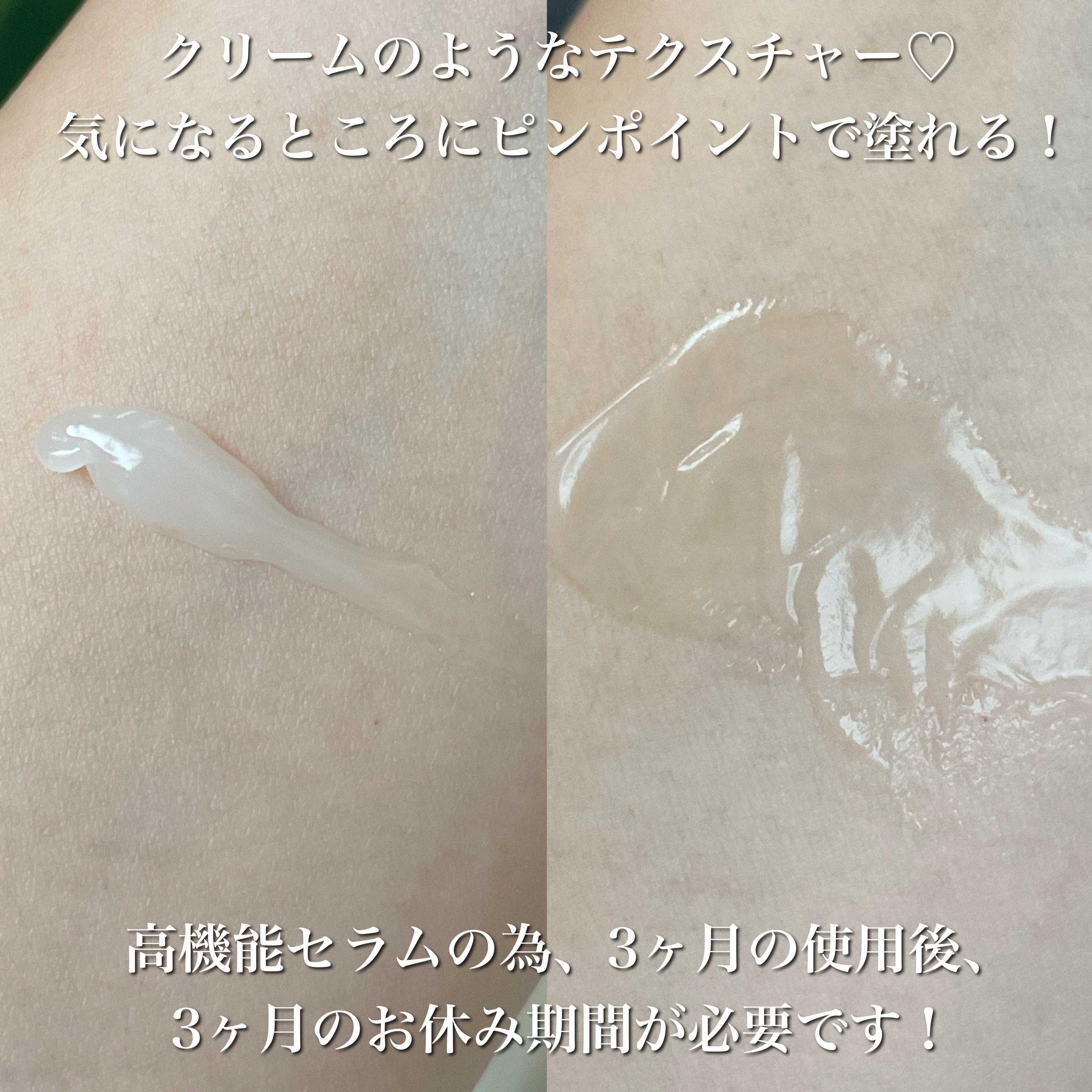 HQ セラム/ダーマセプトRX/美容液を使ったクチコミ（3枚目）
