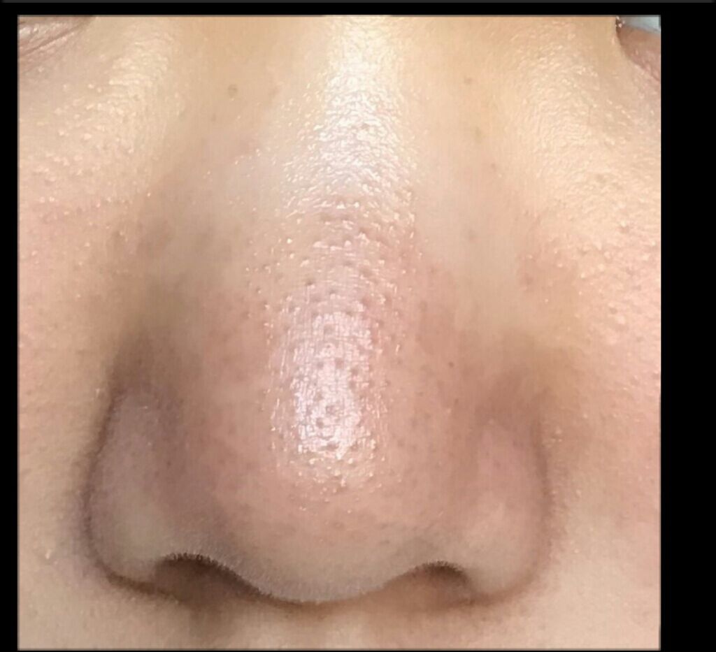 こんにゃく洗顔パフ/セリア/その他スキンケアグッズを使ったクチコミ（1枚目）