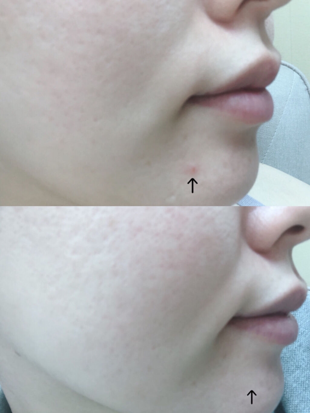 ザビタミンC23/IOPE/美容液を使ったクチコミ（3枚目）