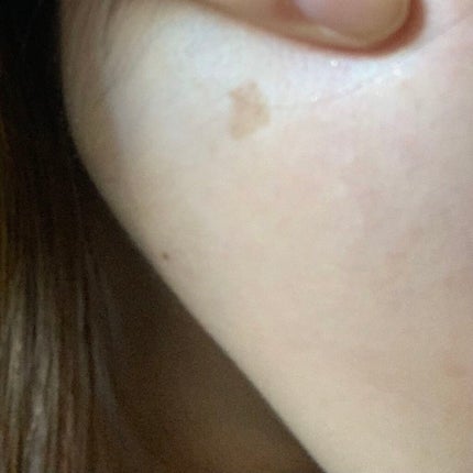 ホワイトCクリア(医薬品)/トランシーノ/その他を使ったクチコミ(1枚目)