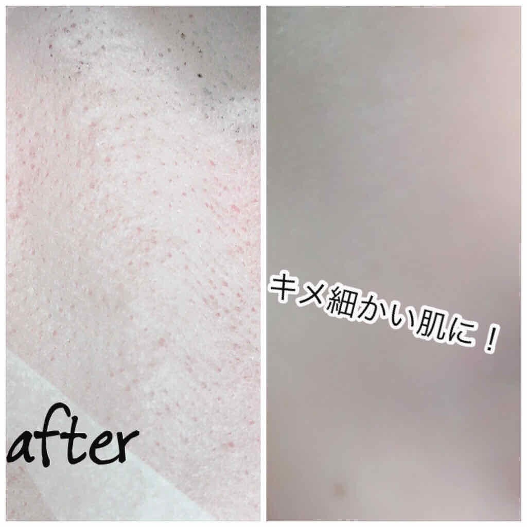 リアル ビッグ ヨーグルト ワン/A’pieu/シートマスク・パックを使ったクチコミ(4枚目)