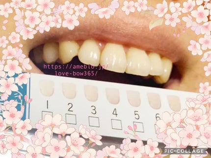 アパガードセレナ/アパガード/歯磨き粉を使ったクチコミ(7枚目)