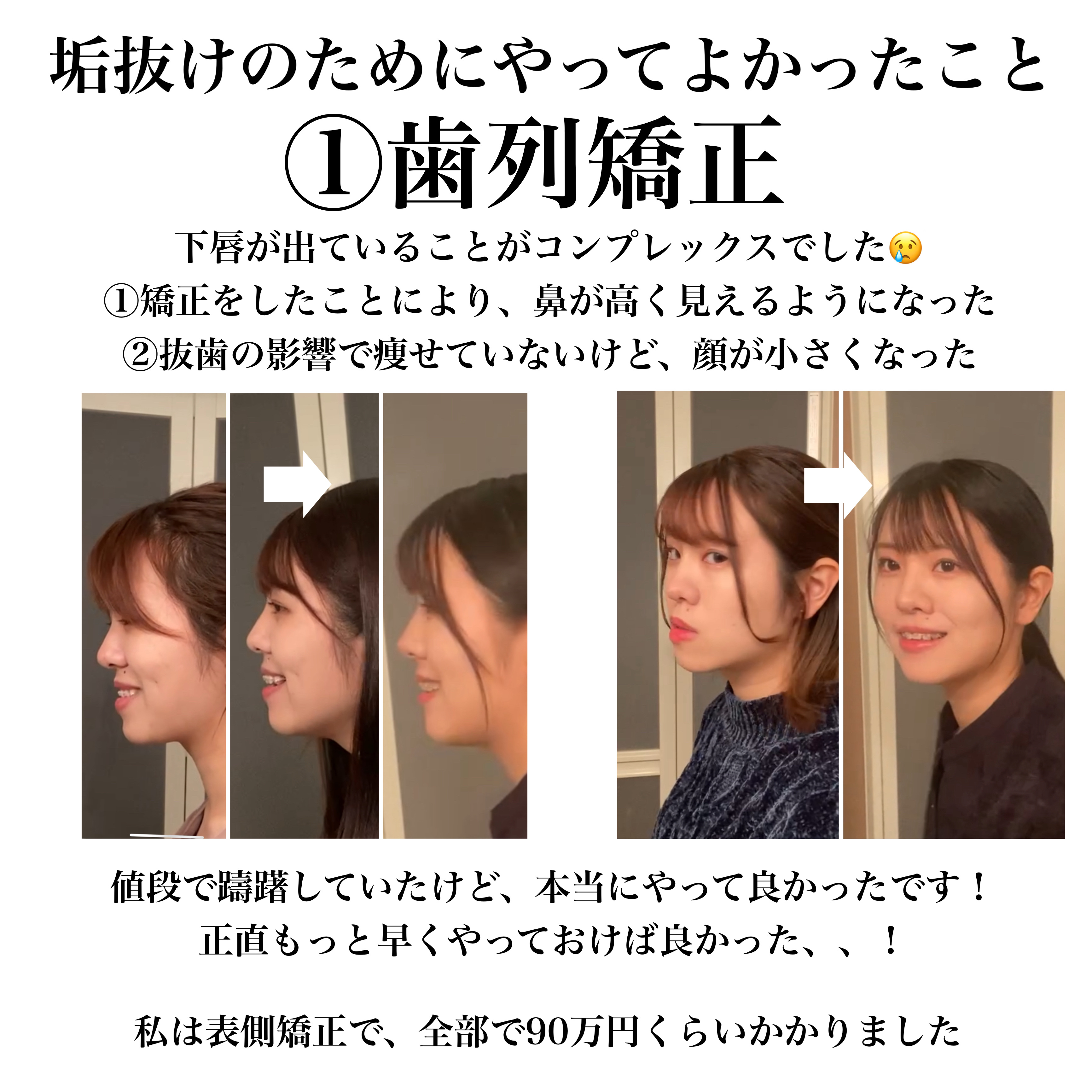 シェーディングパウダー/キャンメイク/シェーディングを使ったクチコミ（2枚目）