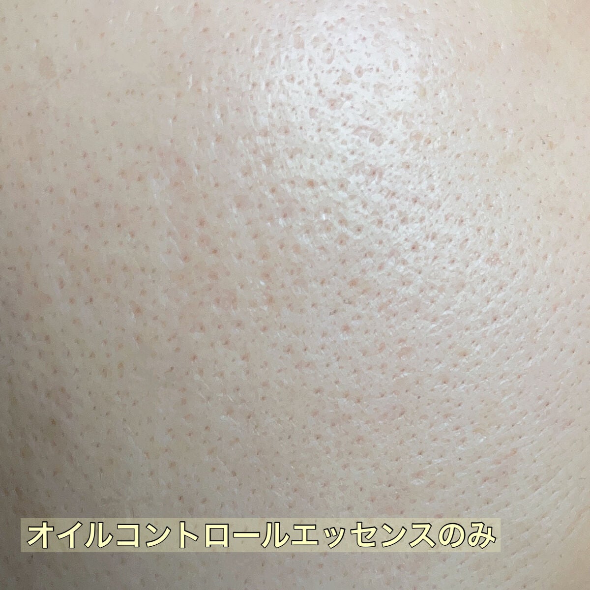 オイルコントロールカプセルエッセンス/celimax/美容液を使ったクチコミ(2枚目)