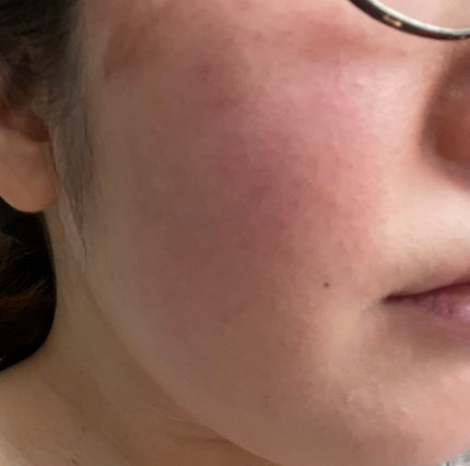 マスクフィットオールカバーデュアルコンシーラー/TIRTIR(ティルティル)/コンシーラーを使ったクチコミ(2枚目)