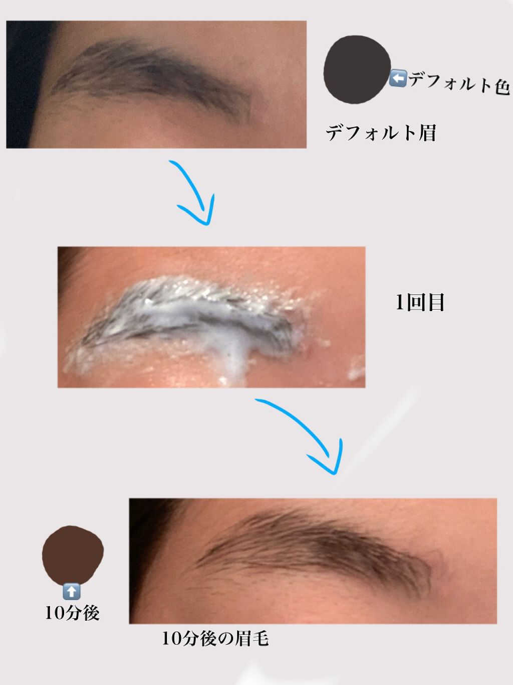 脱色クリーム 敏感肌用/エピラット/ムダ毛ケアを使ったクチコミ（3枚目）