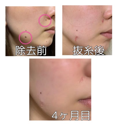 なずな on LIPS 「推しが弄ぶことに味をしめました。皆様こんにちは、なずなです。ほ..」(2枚目)