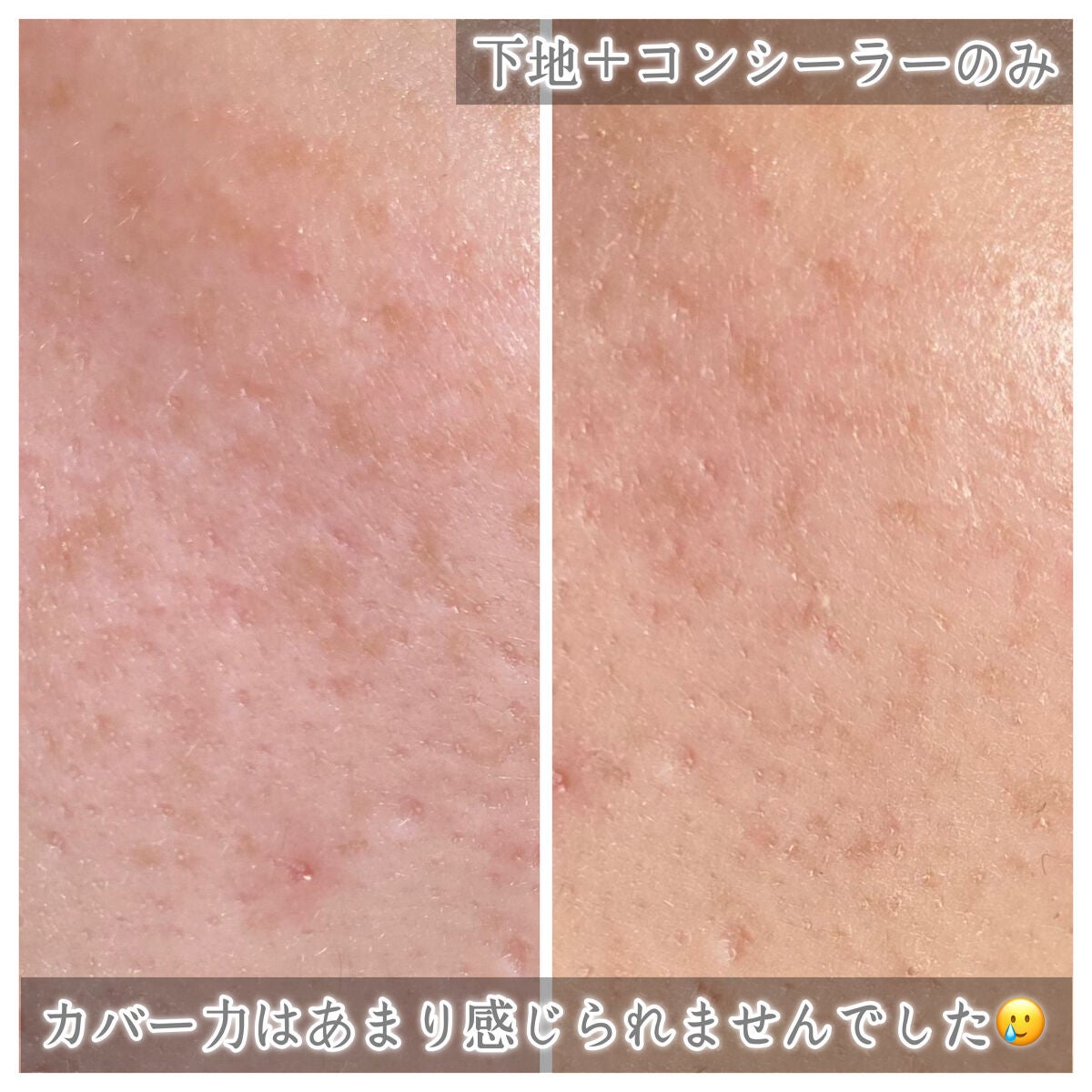 プリズム・リーブル・スキンケアリング・コンシーラー/GIVENCHY/リキッドコンシーラーを使ったクチコミ(5枚目)