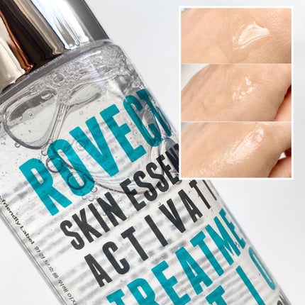 エッセンシャル トリートメントローション/ロベクチン/化粧水を使ったクチコミ(5枚目)