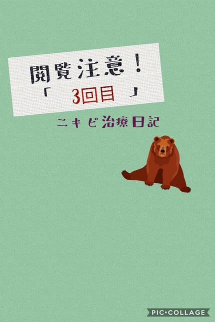 デュアック配合ゲル/ポーラファルマ/その他を使ったクチコミ(1枚目)