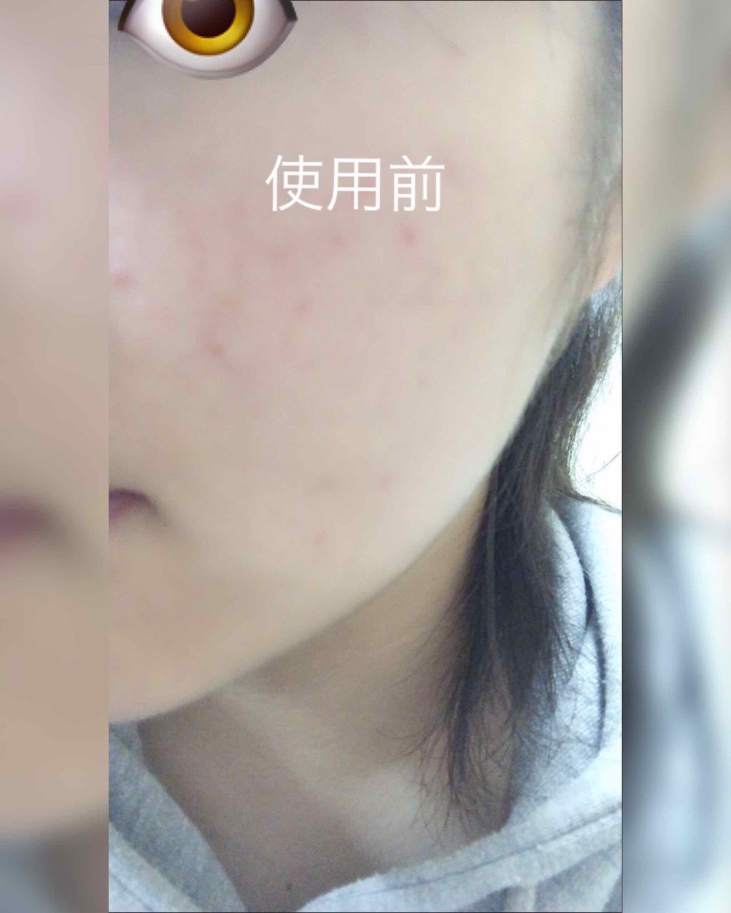 【旧品】マシュマロフィニッシュパウダー/キャンメイク/プレストパウダーを使ったクチコミ(1枚目)