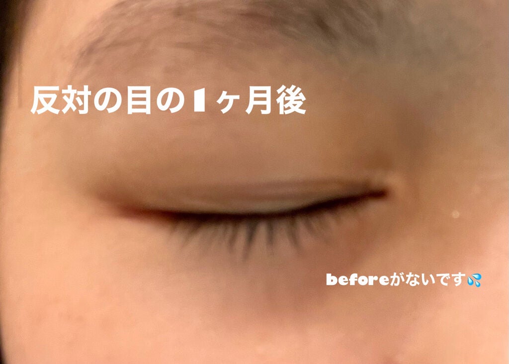 アイラッシュセラム/THE STEM CELL/まつげ美容液を使ったクチコミ(4枚目)