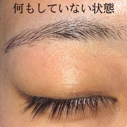 脱色クリーム 敏感肌用/エピラット/ムダ毛ケアを使ったクチコミ(2枚目)