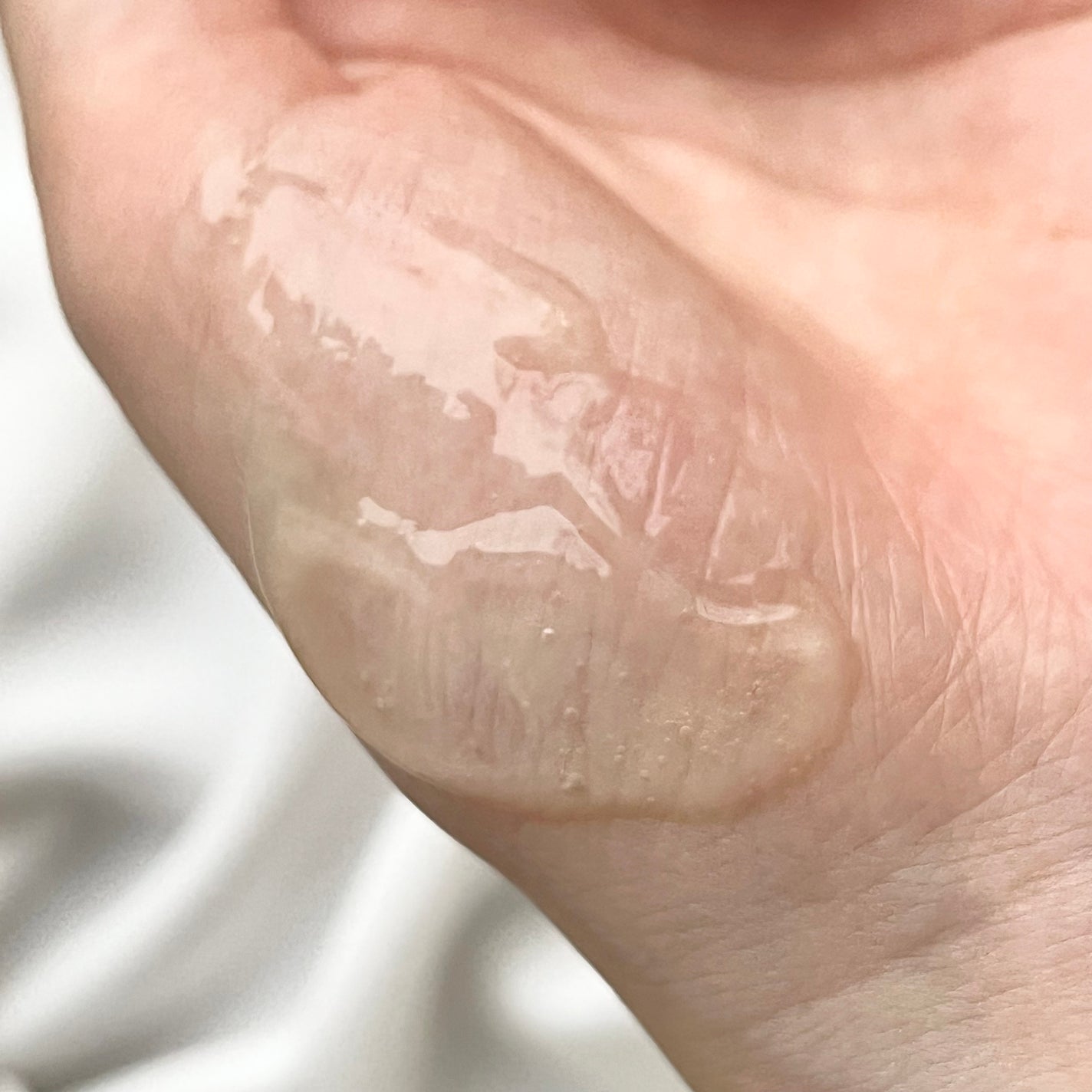 ã°ãªãŒã³ã¿ã³ãžã§ãªã³ ãã¿C ããŒã¯ã¹ãããã±ã¢ã»ã©ã /goodal/çŸå®¹æ¶²ã䜿ã£ãã¯ãã³ãïŒ6æç®ïŒ